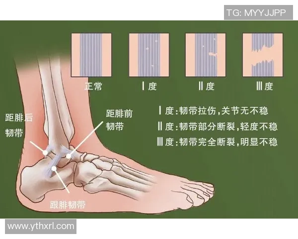 打篮球时韧带断裂的风险与预防措施详解